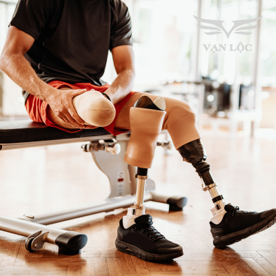 In 3D chân tay giả: Bước tiến thay đổi cuộc sống của người khuyết tật